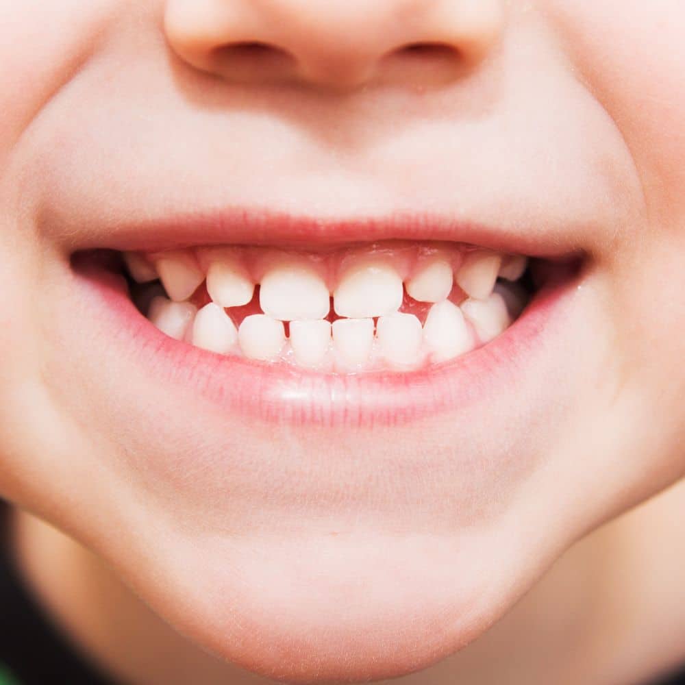 Little kid smiling showing his pretty teeth.