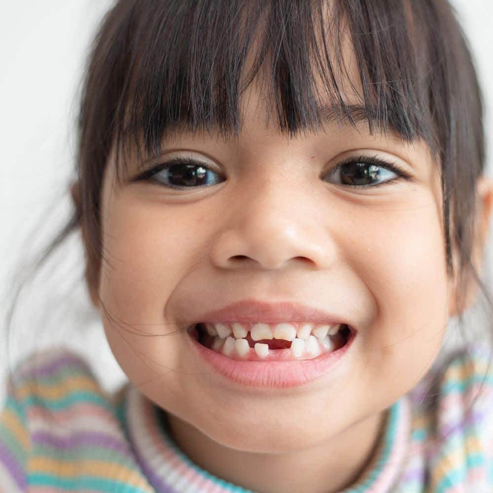 Young girl showing her missing tooth