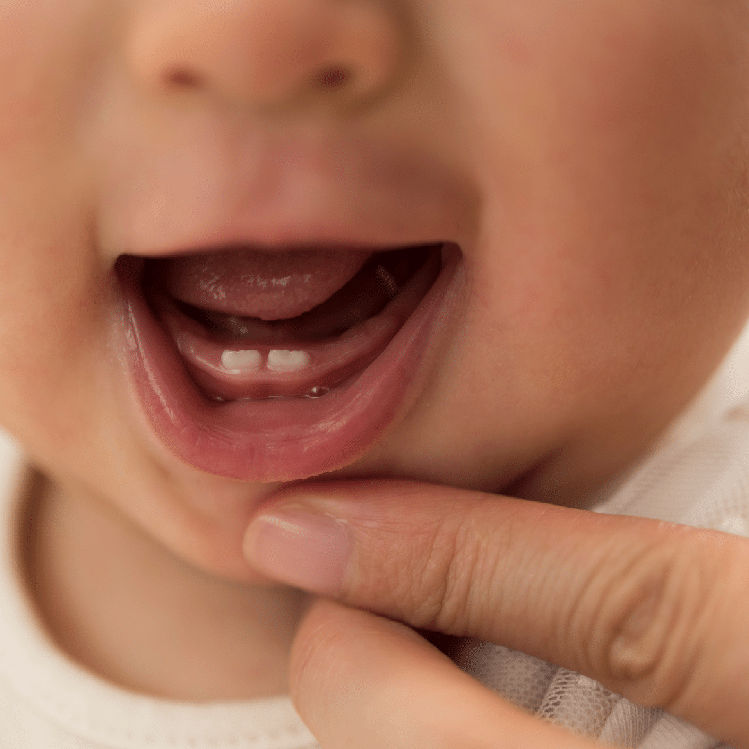 Baby teeth