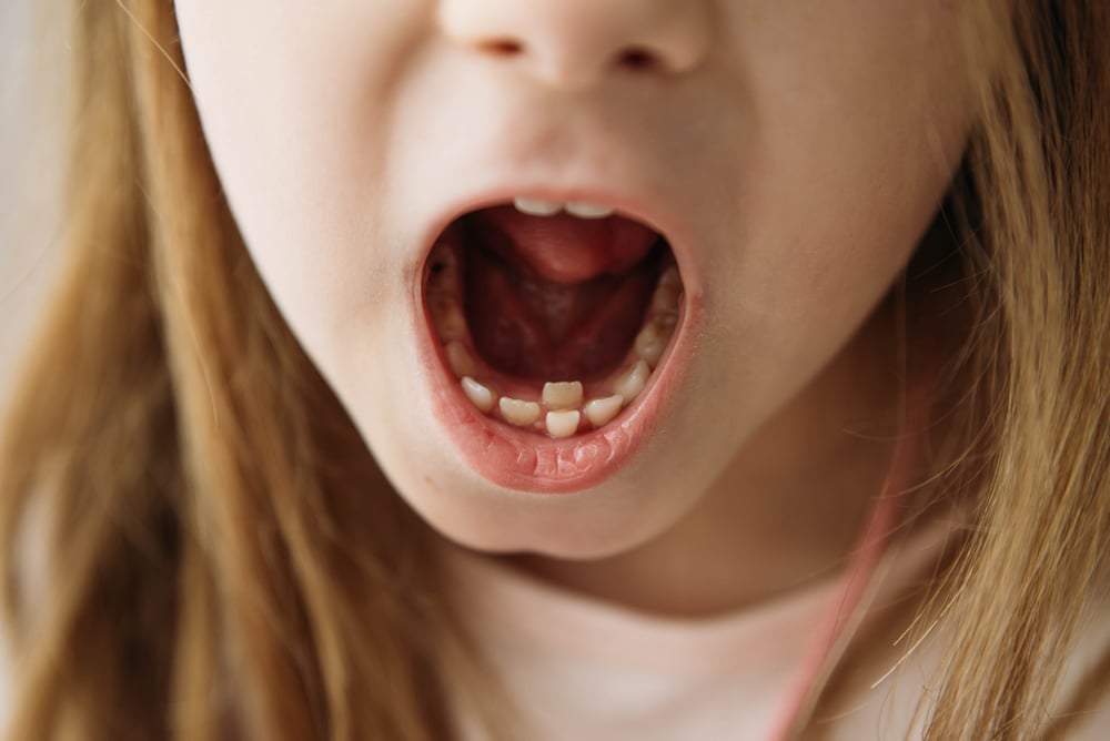 Pediatric Dentist in Cary