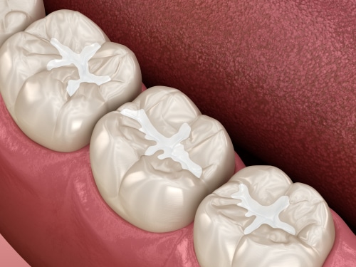 Preston Corners Pediatric Dentistry in Cary, NC